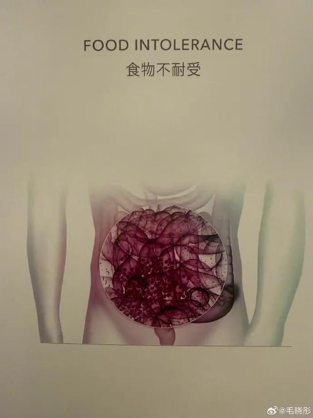 开云体育官方网站-演员毛晓彤凌晨从医美诊所离开引网友热议，其晒医院检测报告回应：作为一个从小爱吃面食的天津人，查出面粉不耐受可怎么办